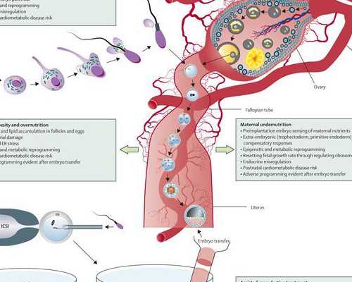 供卵代怀套餐：解析试管婴儿费用报销事宜