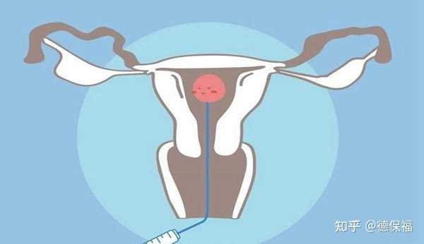 助孕方法有哪些方法|2023湖北供卵助孕机构排名公布，附湖北最大的供卵机构详
